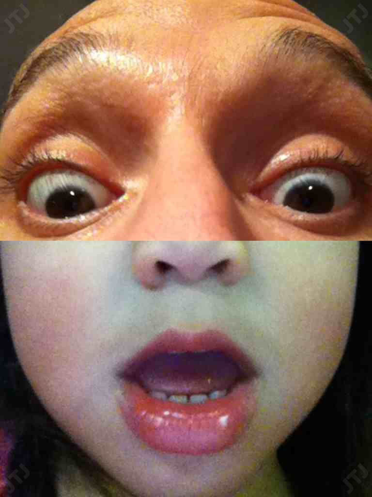 Composite portrait pairing wide-open eyes with another person’s nose and open mouth.